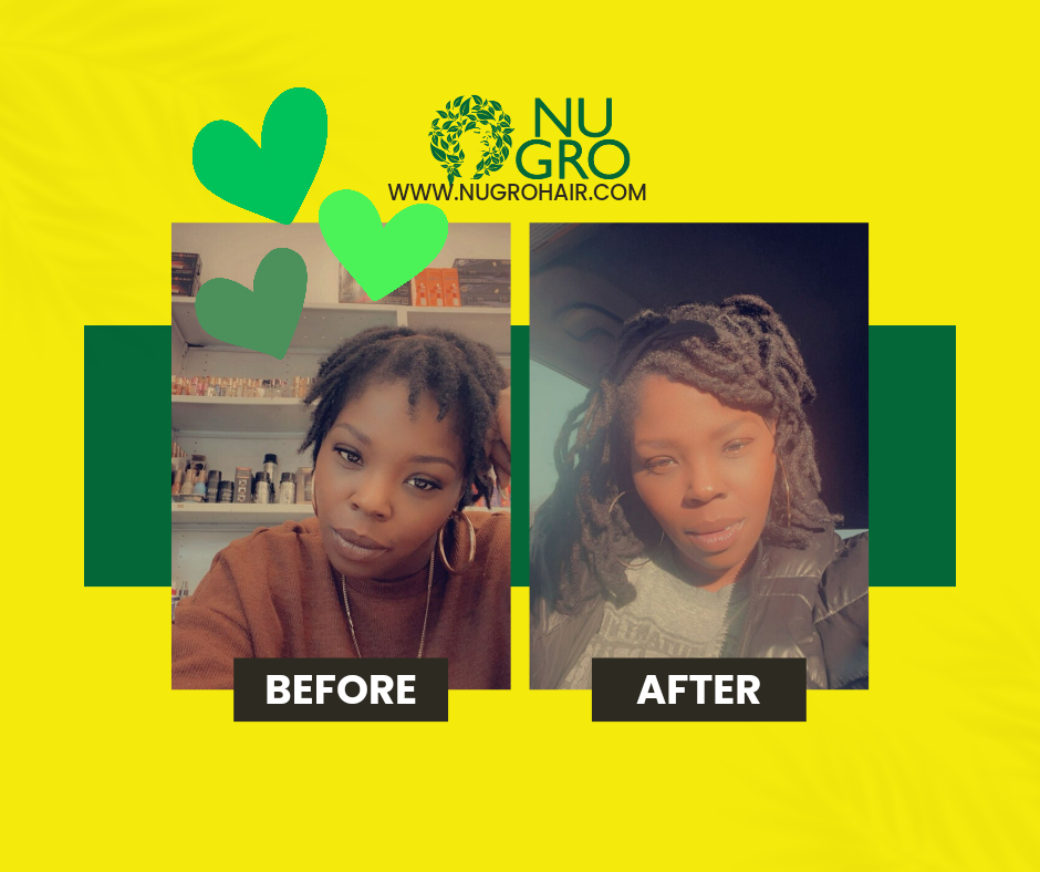 Shot Drop Hair Growth Elixir